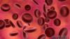 Хемоглобин при деца: Как да повишим хемоглобина при дете: добавки с желязо и допълнителна терапия